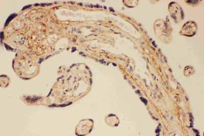 2 - Anti-PSD95 Antibody ABO11603