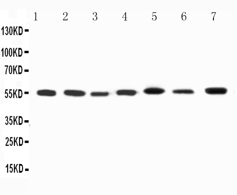 1 - Anti-Kv1.1 Potassium Channel Antibody ABO11604
