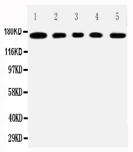 1 - Anti-MUC1 Antibody ABO11610