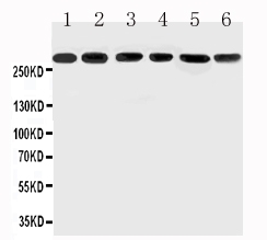 1 - Anti-Mucin 5AC Antibody ABO11611