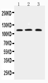 1 - Anti-TRPC4 Antibody ABO11615