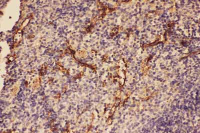 2 - Anti-complement C5a Antibody ABO11616