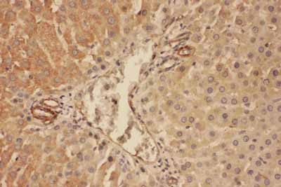2 - Anti-complement C5a Antibody ABO11616