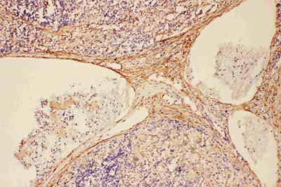 2 - Anti-complement C5a Antibody ABO11616