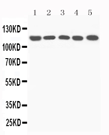 1 - Anti-complement C5a Antibody ABO11616