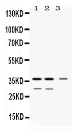 1 - Anti-DDAH1 Picoband Antibody ABO11618