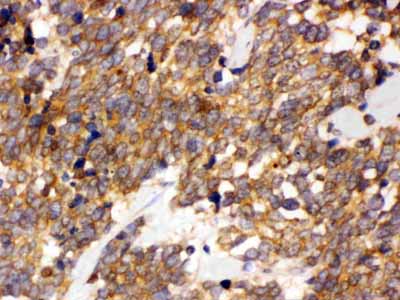 2 - Anti-DDAH2 Picoband Antibody ABO11619