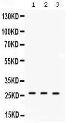 1 - Anti-DDAH2 Picoband Antibody ABO11619