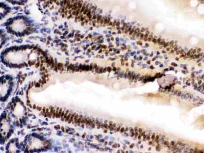 2 - Anti-HMGB2 Picoband Antibody ABO11620