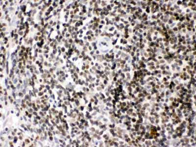2 - Anti-HMGB2 Picoband Antibody ABO11620