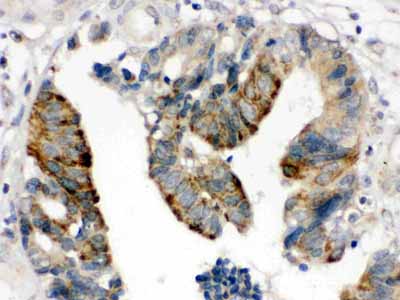 2 - Anti-HMGB2 Picoband Antibody ABO11620