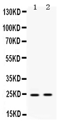1 - Anti-HMGB2 Picoband Antibody ABO11620