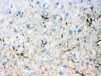2 - Anti-Alpha Internexin Picoband Antibody ABO11621