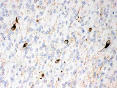 2 - Anti-Alpha Internexin Picoband Antibody ABO11621