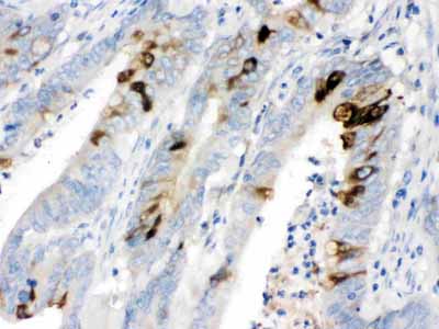 2 - Anti-ITLN1 Picoband Antibody ABO11622