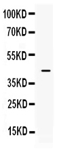 1 - Anti-ITLN1 Picoband Antibody ABO11622