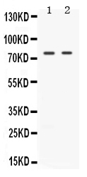 1 - Anti-TAK1 Picoband Antibody ABO11624