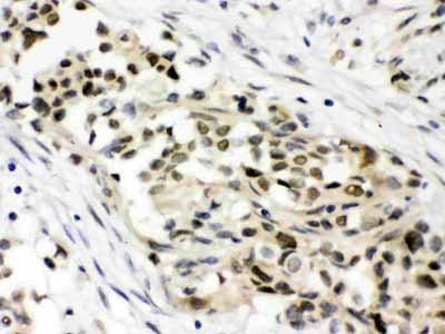2 - Anti-MAP3K8 Picoband Antibody ABO11625