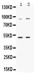 1 - Anti-MAP3K8 Picoband Antibody ABO11625