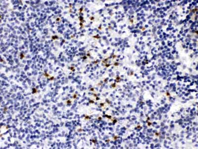 2 - Anti-MMP-9 Picoband Antibody ABO11626