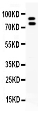 1 - Anti-MMP-9 Picoband Antibody ABO11626