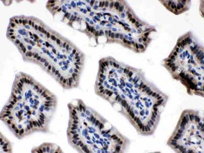 2 - Anti-Visfatin Picoband Antibody ABO11627