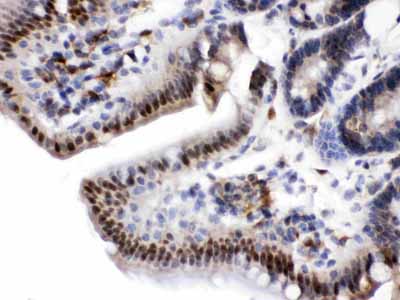 2 - Anti-Visfatin Picoband Antibody ABO11627