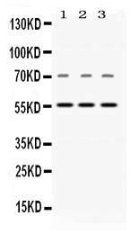 1 - Anti-Visfatin Picoband Antibody ABO11627