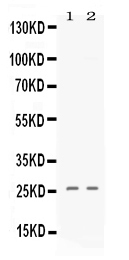 1 - Anti-PF4 Picoband Antibody ABO11629