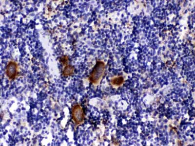 2 - Anti-PF4 Picoband Antibody ABO11630
