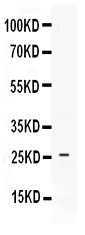 1 - Anti-PF4 Picoband Antibody ABO11630