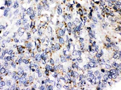 2 - Anti-Perilipin 3 Picoband Antibody ABO11631