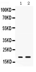 1 - Anti-Peptide YY Picoband Antibody ABO11632