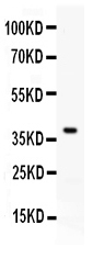 1 - Anti-TNFSF11/RANKL Picoband Antibody ABO11633