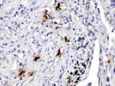 2 - Anti-Mast Cell Tryptase Picoband Antibody ABO11634