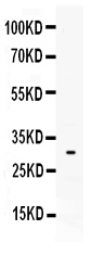 1 - Anti-Mast Cell Tryptase Picoband Antibody ABO11634
