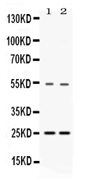 1 - Anti-SYBL1 Picoband Antibody ABO11635