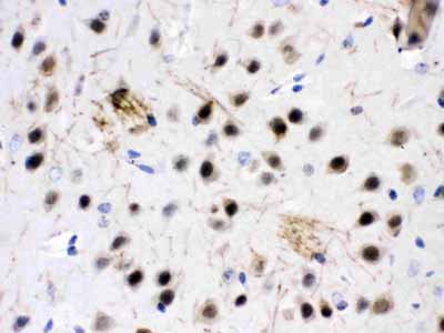 2 - Anti-ZWINT Picoband Antibody ABO11636