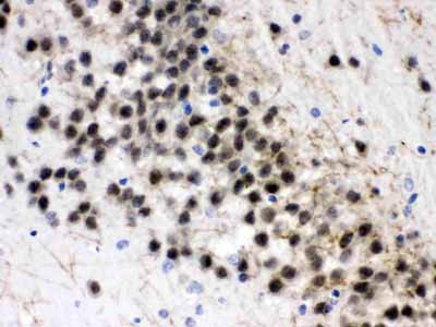 2 - Anti-ZWINT Picoband Antibody ABO11636