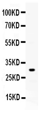 1 - Anti-ZWINT Picoband Antibody ABO11636