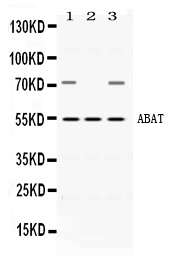 1 - Anti-ABAT Picoband Antibody ABO11637