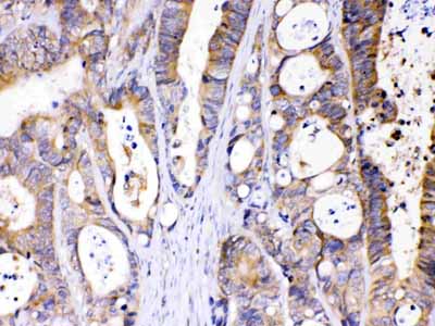 2 - Anti-Abhd5 Picoband Antibody ABO11639