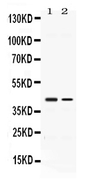 1 - Anti-Abhd5 Picoband Antibody ABO11639