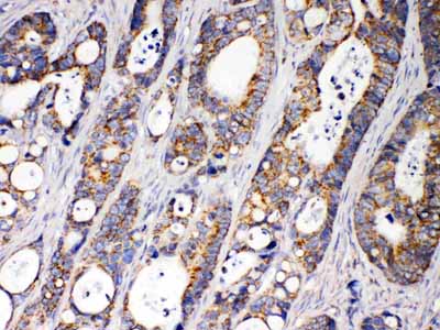 2 - Anti-ACAA2 Picoband Antibody ABO11640