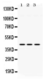 1 - Anti-ACAA2 Picoband Antibody ABO11640