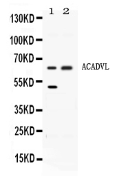 1 - Anti-ACADVL Picoband Antibody ABO11641