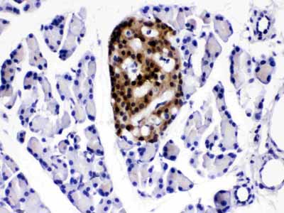 2 - Anti-ATP citrate lyase Picoband Antibody ABO11642