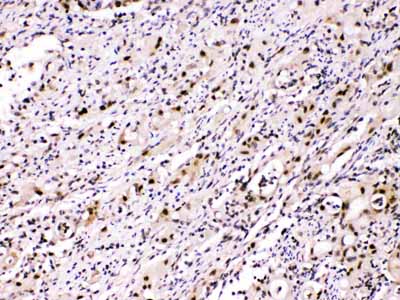 2 - Anti-ATP citrate lyase Picoband Antibody ABO11642