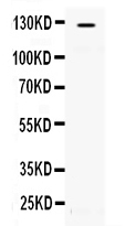 1 - Anti-ATP citrate lyase Picoband Antibody ABO11642