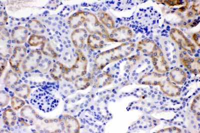 2 - Anti-ACSL1 Picoband Antibody ABO11643
